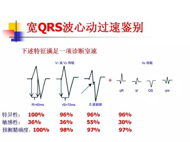 幻灯精粹 郭继鸿|宽qrs波心动过速的鉴别  北京大学人民医院主任医师